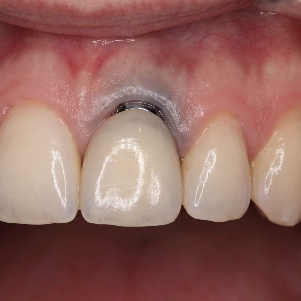 Before treatment